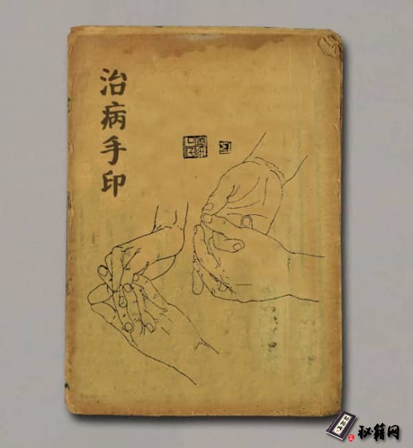 《治病手印》
